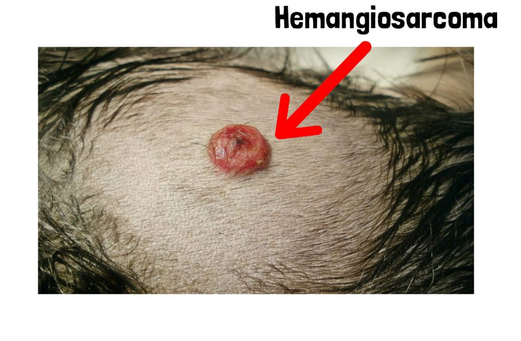 Hemangiosarcoma